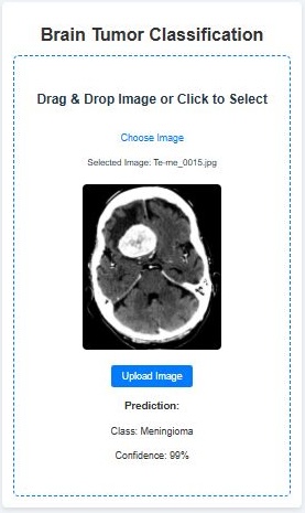 Brain Tumor Classification project screenshot.